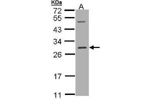 WB Image Sample (30 ug of whole cell lysate) A: Hep G2 , 12% SDS PAGE antibody diluted at 1:1000 (RALB 抗体  (full length))