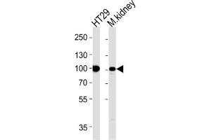 Western Blotting (WB) image for anti-Villin 1 (VIL1) antibody (ABIN3002792) (Villin 1 抗体)
