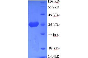 SDS-PAGE (SDS) image for Heat Shock 70kDa Protein 5 (Glucose-Regulated Protein, 78kDa) (HSPA5) (AA 25-293), (partial) protein (His tag) (ABIN5712375)