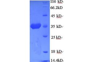 SDS-PAGE (SDS) image for Heat Shock 70kDa Protein 5 (Glucose-Regulated Protein, 78kDa) (HSPA5) (AA 25-293), (partial) protein (His tag) (ABIN5712375) (GRP78 Protein (AA 25-293, partial) (His tag))