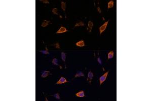Immunofluorescence (IF) image for anti-Sema Domain, Immunoglobulin Domain (Ig), Transmembrane Domain (TM) and Short Cytoplasmic Domain, (Semaphorin) 4A (Sema4a) (AA 320-580) antibody (ABIN7270199)