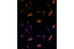 Immunofluorescence analysis of L929 cells using SEMA antibody (ABIN7270199) at dilution of 1:100. (Sema4a 抗体  (AA 320-580))