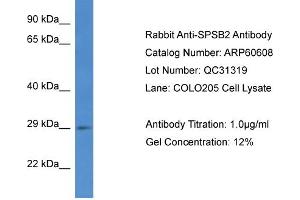 Western Blotting (WB) image for anti-SplA/ryanodine Receptor Domain and SOCS Box Containing 2 (SPSB2) (C-Term) antibody (ABIN2788511) (SPSB2 抗体  (C-Term))