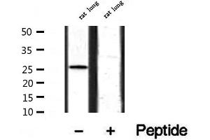 Western blot analysis of extracts from rat lung, using BCA3 Antibody. (AKIP1 抗体  (Internal Region))