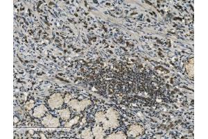 IHC analysis of PARP using anti-PARP antibody (ABIN7602278). (PARP1 抗体  (AA 670-858))