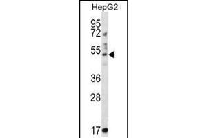 Western blot analysis in HepG2 cell line lysates (35ug/lane). (TRIM11 抗体  (C-Term))