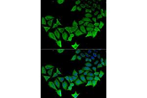 Immunofluorescence analysis of HeLa cells using APLP1 antibody (ABIN5975741). (APLP1 抗体)