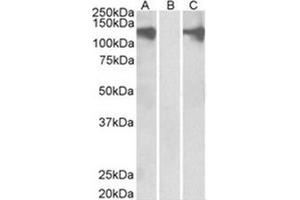 Image no. 1 for anti-Pumilio Homolog 2 (Drosophila) (PUM2) (Internal Region) antibody (ABIN374533) (PUM2 抗体  (Internal Region))