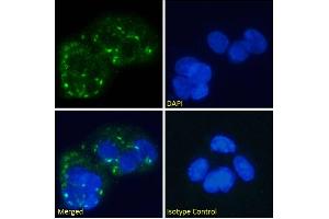 Immunofluorescence staining of fixed HepG2 cells with anti-Human Glucagon Receptor antibody hGR-2 F6. (Recombinant Glucagon Receptor 抗体)
