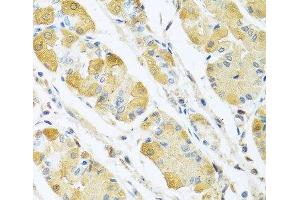 Immunohistochemistry of paraffin-embedded Human stomach using C4BPB Polyclonal Antibody at dilution of 1:100 (40x lens). (C4BPB 抗体)