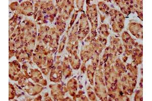 IHC image of ABIN7161327 diluted at 1:300 and staining in paraffin-embedded human pancreatic cancer performed on a Leica BondTM system. (NLN 抗体  (AA 109-241))