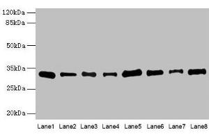Western blot All lanes: PLP1 antibody at 4 μg/mL Lane 1: Hela whole cell lysate Lane 2: HL60 whole cell lysate Lane 3: K562 whole cell lysate Lane 4: THP-1 whole cell lysate Lane 5: U937 whole cell lysate Lane 6: A549 whole cell lysate Lane 7: Caco-2 whole cell lysate Lane 8: HepG2 whole cell lysate Secondary Goat polyclonal to rabbit IgG at 1/10000 dilution Predicted band size: 31, 27 kDa Observed band size: 31 kDa (PLP1 抗体  (AA 143-197))