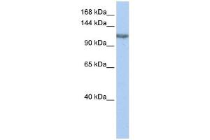 TGS1 antibody used at 1 ug/ml to detect target protein. (TGS1 抗体)