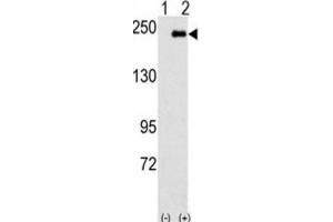 Western Blotting (WB) image for anti-Sperm Associated Antigen 9 (SPAG9) antibody (ABIN3003116) (SPAG9 抗体)