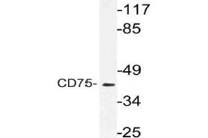Western blot (WB) analysis of CD75 antibody in extracts from RAW264. (ST6GAL1 抗体)