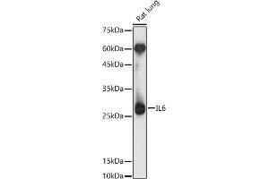 Western blot analysis of extracts of Rat lung, using IL6 antibody (ABIN1513075, ABIN1514222, ABIN1683697 and ABIN6213773) at 1:1000 dilution. (IL-6 抗体  (AA 30-212))