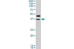 PAX8 monoclonal antibody (M10), clone 3G11. (PAX8 抗体  (AA 300-377))
