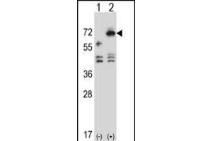 Western blot analysis of ARSF (arrow) using rabbit polyclonal ARSF Antibody (Center) (ABIN657171 and ABIN2846304). (ARSF 抗体  (AA 236-264))