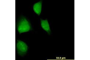 Immunofluorescence of monoclonal antibody to MAPKAPK2 on HeLa cell. (MAPKAP Kinase 2 抗体  (AA 266-352))