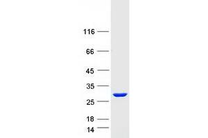 Western Blotting (WB) image for Syndecan Binding Protein (Syntenin) 2 (SDCBP2) (Transcript Variant 2) protein (Myc-DYKDDDDK Tag) (ABIN2733120)