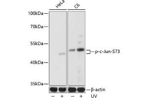 Western blot analysis of extracts of various cell lines, using Phospho-c-Jun-S73 antibody (ABIN3023567, ABIN3023568, ABIN3023569 and ABIN6225411) at 1:1000 dilution. (C-JUN 抗体  (pSer73))