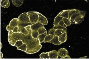 Immunohistochemistry (IHC) image for anti-Cadherin 1, Type 1, E-Cadherin (Epithelial) (CDH1) (C-Term) antibody (ABIN967801) (E-cadherin 抗体  (C-Term))