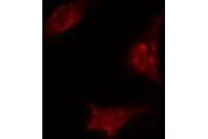 Immunofluorescence (fixed cells) (IF/ICC) image for anti-TAF5 RNA Polymerase II, TATA Box Binding Protein (TBP)-Associated Factor, 100kDa (TAF5) (Internal Region) antibody (ABIN6259229)