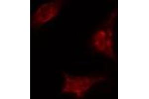 ABIN6274367 staining A549 cells by IF/ICC.