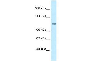 WB Suggested Anti-Grik5 Antibody   Titration: 1. (GRIK5 抗体  (N-Term))