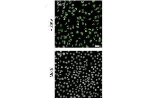 IF of Zika infected cells (Flavivirus E protein 抗体)