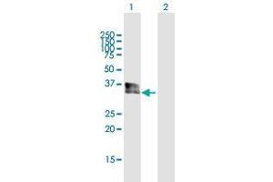 Western Blotting (WB) image for anti-Sprouty Homolog 1, Antagonist of FGF Signaling (SPRY1) (AA 1-319) antibody (ABIN1989532)