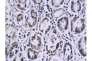 Formalin-fixed and paraffin embedded: mouse small intestine tissue labeled with Anti-PCNA Polyclonal Antibody (ABIN669366), Unconjugated followed by conjugation to the secondary antibody and DAB staining (SPINK7/ECRG2 抗体  (AA 51-85))