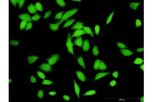 Immunofluorescence of purified MaxPab antibody to CUL1 on HeLa cell. (Cullin 1 抗体  (AA 1-776))