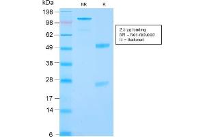 SDS-PAGE Analysis Purified RCC Rabbit Recombinant Monoclonal Antibody (CA9/2993R). (Recombinant CA9 抗体)