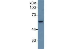 Western Blotting (WB) image for anti-CAP, Adenylate Cyclase-Associated Protein 1 (CAP1) (AA 38-149) antibody (ABIN7438262)