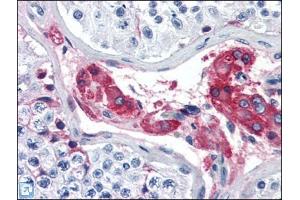 Human Testis (formalin-fixed, paraffin-embedded) stained with F12at 5 µg/ml followed by biotinylated anti-goat IgG secondary antibody, alkaline phosphatase-streptavidin and chromogen. (F12 抗体)