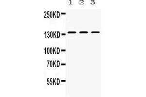Western blot analysis of Nephrin expression in rat kidney extract ( Lane 1), mouse kidney extract ( Lane 2) and 293T whole cell lysates ( Lane 3). (Nephrin 抗体  (AA 1084-1241))
