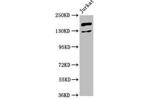 Western Blot Positive WB detected in: Jurkat whole cell lysate All lanes: CASZ1 antibody at 4. (CASZ1 抗体  (AA 127-266))