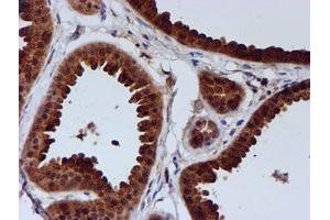 Immunohistochemical staining of paraffin-embedded Human breast tissue using anti-C1orf50 mouse monoclonal antibody. (C1ORF50 抗体)
