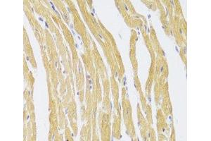 Immunohistochemistry of paraffin-embedded Mouse heart using CSRP3 Polyclonal Antibody at dilution of 1:100 (40x lens). (CSRP3 抗体)
