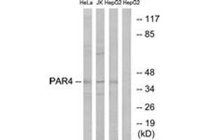Western blot analysis of extracts from HepG2/Jurkat/HeLa cells, using PAR4 Antibody.