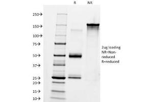 SDS-PAGE Analysis of Purified, BSA-Free Anti-IgM Antibody (clone IM260). (小鼠 anti-人 IgM Antibody)