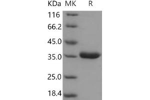Western Blotting (WB) image for Protease, serine, 8 (PRSS8) (AA 30-289) protein (His tag) (ABIN7197548) (PRSS8 Protein (AA 30-289) (His tag))