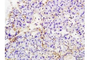 Formalin-fixed and paraffin embedded rat pancreas tissue labeled with Anti-MTUS1 Polyclonal Antibody, Unconjugated  at 1:200 followed by conjugation to the secondary antibody and DAB staining (MTUS1 抗体  (AA 1151-1270))