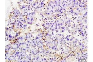 Formalin-fixed and paraffin embedded rat pancreas tissue labeled with Anti-MTUS1 Polyclonal Antibody, Unconjugated  at 1:200 followed by conjugation to the secondary antibody and DAB staining (MTUS1 抗体  (AA 1151-1270))
