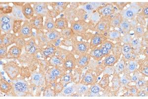 Immunohistochemistry of paraffin-embedded Mouse liver using APCS Polyclonal Antibody at dilution of 1:100 (40x lens). (APCS 抗体)