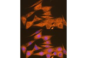 Immunofluorescence analysis of NIH-3T3 cells using PDI Rabbit mAb (ABIN7269615) at dilution of 1:100 (40x lens).