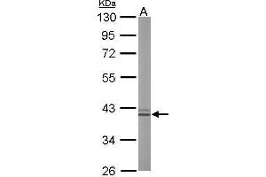 Liver Arginase 抗体