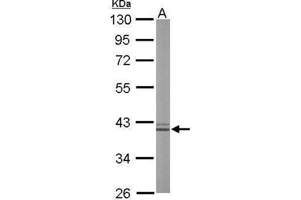 Liver Arginase 抗体