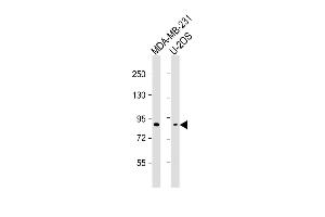 All lanes : Anti-SMURF2 Antibody at 1:2000-1:4000 dilution Lane 1: MDA-MB-231 whole cell lysate Lane 2: U-2OS whole cell lysate Lysates/proteins at 20 μg per lane. (SMURF2 抗体)